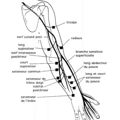 compression du nerf radial trajet nerf radial bras chirurgien coude paris chirurgien nerfs paris maladie atteintes nerfs peripheriques docteur patrick houvet