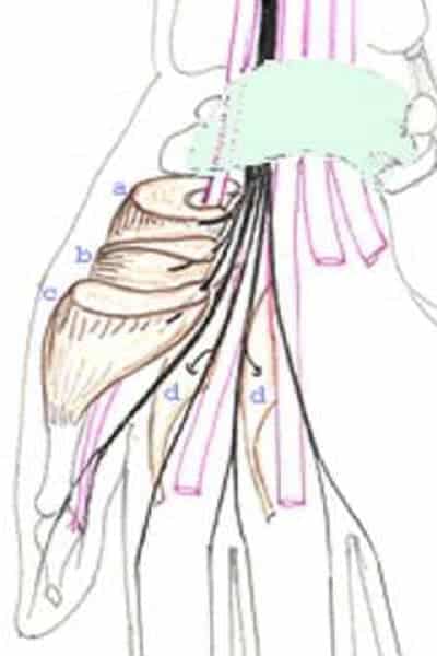 compression nerveuse main nerf dans la main chirurgien main paris chirurgien nerfs paris maladie atteintes nerfs peripheriques docteur patrick houvet