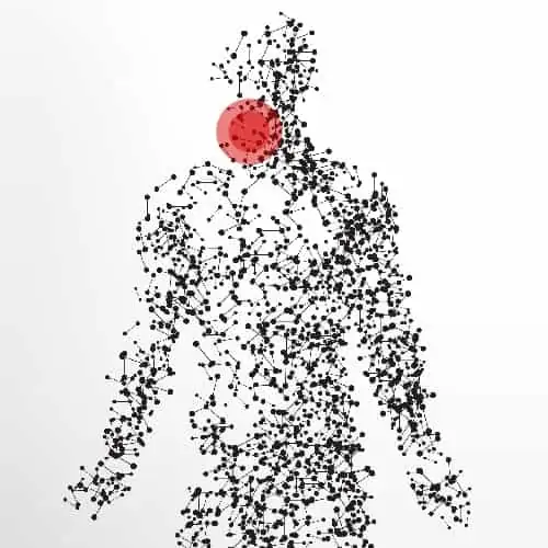 hernie cervicale symptomes cervicale douleur cervicale et maux de tete pathologies des nerfs peripheriques docteur patrick houvet paris hernie cervicale symptomes cervicale douleur cervicale et maux de tete pathologies des nerfs peripheriques docteur patrick houvet paris