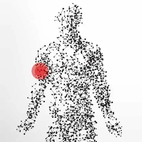 mal au bras qui pendent solution bras qui tremble cause pathologies des nerfs peripheriques docteur patrick houvet paris mal au bras qui pendent solution bras qui tremble cause pathologies des nerfs peripheriques docteur patrick houvet paris