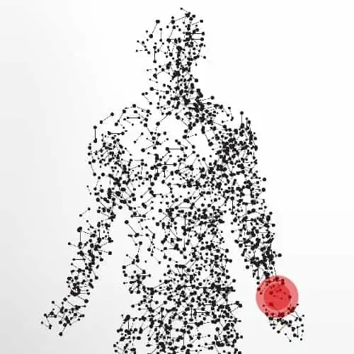 tendinite poignet que faire poignet qui craque douleur poignet quand je tourne pathologies des nerfs peripheriques docteur patrick houvet paris tendinite poignet que faire poignet qui craque douleur poignet quand je tourne pathologies des nerfs peripheriques docteur patrick houvet paris